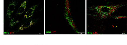 Effect of CoQ depletion on spheroids formation