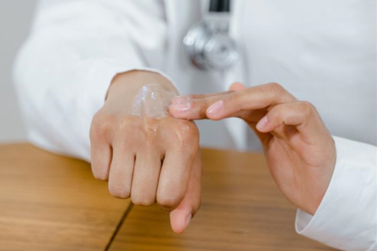 Film reidratabili per la veicolazione dei farmaci