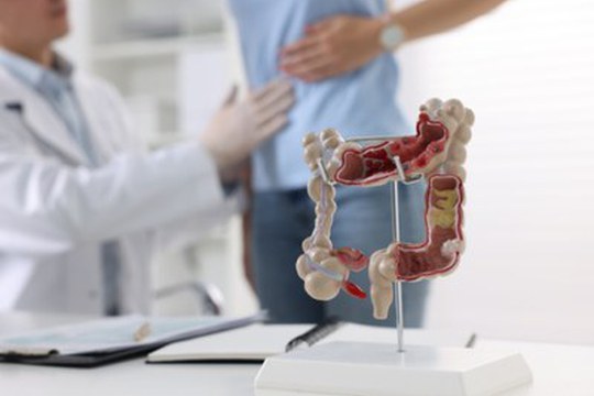 Nuova luce sui meccanismi gastrointestinali nella malattia di Fabry