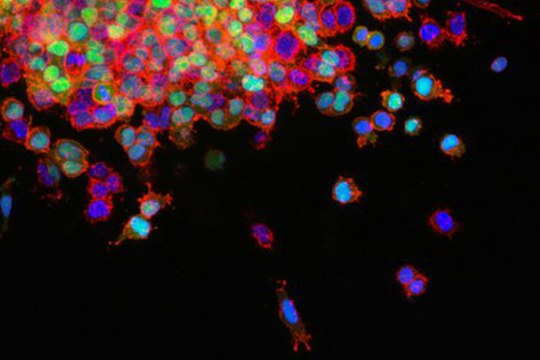Scoperto un nuovo meccanismo che impedisce la replicazione delle cellule tumorali