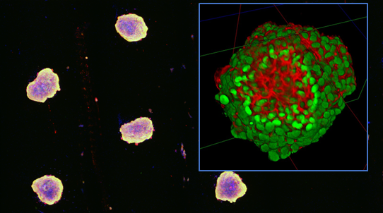 Coltura di sferoidi cellulari su supporti microstrutturati (immagini di microscopia a fluorescenza)
